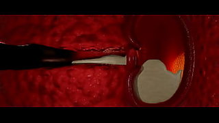 ragini mms 2 xvideos